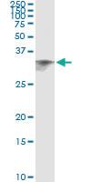 Anti-CIDEA Mouse Monoclonal Antibody [clone: 4B9]