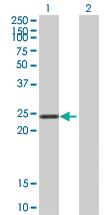 Anti-STYX Mouse Polyclonal Antibody