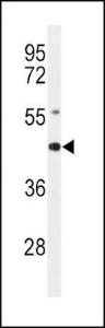 Anti-AGER Rabbit Polyclonal Antibody (Biotin)