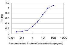 Anti-HNRNPM Mouse Monoclonal Antibody [clone: 3F7]