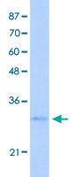 Anti-EXOSC6 Rabbit Polyclonal Antibody