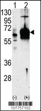 Anti-Guanylyl Cyclase alpha 1 (GUCY1A3) Rabbit Polyclonal Antibody