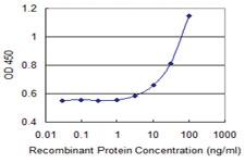 Anti-CIDEA Mouse Monoclonal Antibody [clone: 4B9]