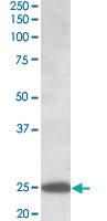 Anti-ABHD14B Goat Polyclonal Antibody