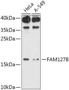 Western blot analysis of extracts of various cell lines, using Anti-RTL8A Antibody (A307132) at 1:1000 dilution