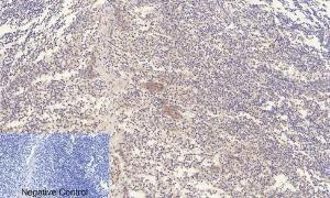 Immunohistochemical analysis of paraffin-embedded human Tonsil tissue using Anti-ERK1 + ERK2 (phospho Thr202) Antibody at 1:200 (4°C overnight). Negative control was secondary antibody only.