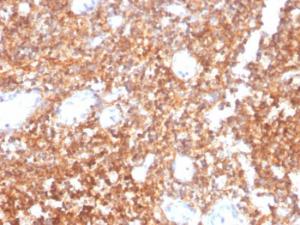 Immunohistochemical analysis of formalin-fixed, paraffin-embedded human tonsil tissue using Anti-CD20 Antibody [MS4A1/4655]