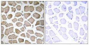 Immunohistochemical analysis of paraffin-embedded human skeletal muscle tissue using Anti-MOT12 Antibody. The right hand panel represents a negative control, where the Antibody was pre-incubated with the immunising peptide