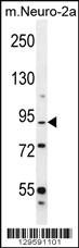 Anti-DIEXF Rabbit Polyclonal Antibody