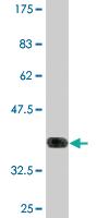 Anti-POLQ Mouse Monoclonal Antibody [clone: 1C11]