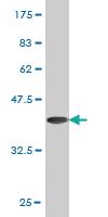 Anti-NDUFV2 Mouse Monoclonal Antibody [clone: 1A10]