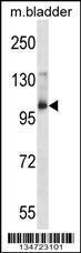 Anti-AAK1 Rabbit Polyclonal Antibody (HRP (Horseradish Peroxidase))