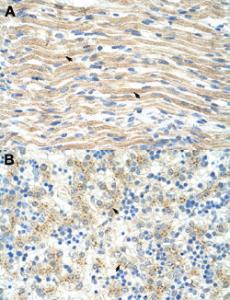 Anti-EXOSC6 Rabbit Polyclonal Antibody