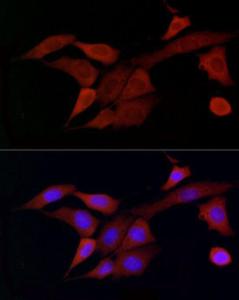 Immunofluorescence analysis of NIH/3T3 cells using Anti-DOK4 Antibody (A12554) at a dilution of 1:50 (40X lens). DAPI was used to stain the cell nuclei (blue)