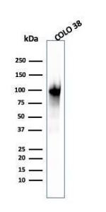 Western blot analysis of COLO-38 cell lysate using Anti-Melanoma gp100 Antibody [PMEL/2039]