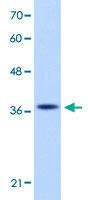 Anti-EXOSC7 Rabbit Polyclonal Antibody