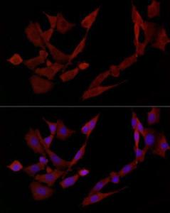 Immunofluorescence analysis of PC-12 cells using Anti-DOK4 Antibody (A12554) at a dilution of 1:50 (40X lens). DAPI was used to stain the cell nuclei (blue)