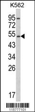 Anti-CYP2E1 Rabbit Polyclonal Antibody