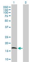 Anti-CIRBP Rabbit Polyclonal Antibody