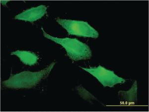 Anti-TNFSF11 Mouse Monoclonal Antibody [clone: 3F7]