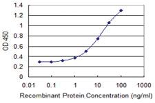 Anti-RBM15 Mouse Monoclonal Antibody [clone: 3E2]