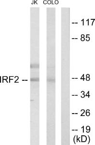 Western blot analysis of lysates from Jurkat and COLO205 cells using Anti-IRF2 Antibody. The right hand lane represents a negative control, where the antibody is blocked by the immunising peptide.