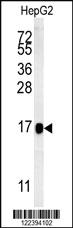 Anti-BLOC1S2 Rabbit Polyclonal Antibody