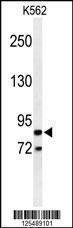 Anti-AVIL Rabbit Polyclonal Antibody (AP (Alkaline Phosphatase))