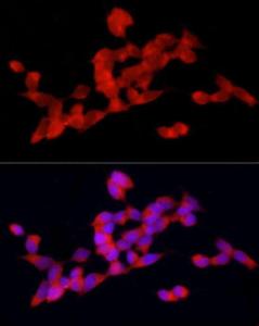 Immunofluorescence analysis of SH-SY5Y cells using Anti-DOK4 Antibody (A12554) at a dilution of 1:50 (40X lens). DAPI was used to stain the cell nuclei (blue)