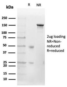 SDS-PAGE analysis of Anti-CD20 Antibody [MS4A1/4655] under non-reduced and reduced conditions; showing intact IgG and intact heavy and light chains, respectively SDS-PAGE analysis confirms the integrity and purity of the antibody