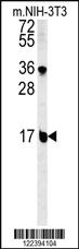 Anti-BLOC1S2 Rabbit Polyclonal Antibody