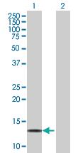 Anti-LDOC1 Mouse Polyclonal Antibody