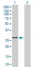 Anti-STYX Rabbit Polyclonal Antibody