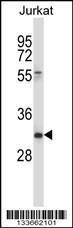 Anti-CD7 Rabbit Polyclonal Antibody (PE (Phycoerythrin))