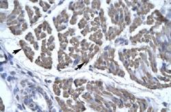 Anti-EYA3 Rabbit Polyclonal Antibody