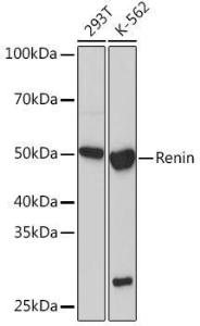 Western blot analysis of extracts of various cell lines, using Anti-Renin Antibody [ARC1149] (A307134) at 1:1000 dilution. The secondary Antibody was Goat Anti-Rabbit IgG H&L Antibody (HRP) at 1:10000 dilution. Lysates/proteins were present at 25 µg per lane