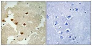 Antibody anti-huntingtin phospho SER421