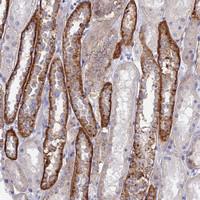 Anti-CHSY3 Rabbit Polyclonal Antibody