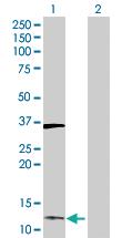 Anti-DUSP23 Rabbit Polyclonal Antibody