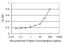 Anti-AKR1D1 Polyclonal Antibody Pair