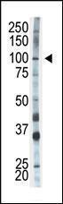 Anti-HK1 Rabbit Polyclonal Antibody (AP (Alkaline Phosphatase))