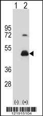 Anti-HOMER3 Rabbit Polyclonal Antibody (AP (Alkaline Phosphatase))