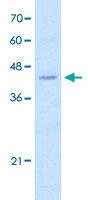 Anti-FADS1 Rabbit Polyclonal Antibody