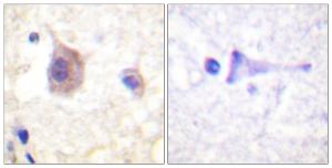 Immunohistochemical analysis of paraffin-embedded human brain using Anti-PKC mu (phospho Tyr463) Antibody The right hand panel represents a negative control, where the antibody was pre-incubated with the immunising peptide