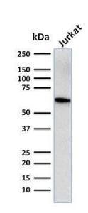 Western blot analysis of human Jurkat cell lysate using Anti-CD5 Antibody [CD5/2416]