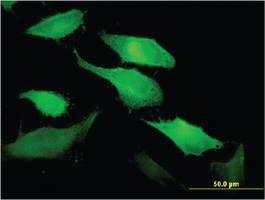 Anti-TNFSF11 Mouse Monoclonal Antibody [clone: 3F7]