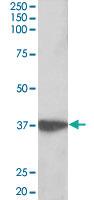 Anti-AIMP1 Goat Polyclonal Antibody