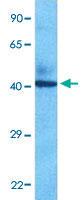 Anti-FADS1 Rabbit Polyclonal Antibody