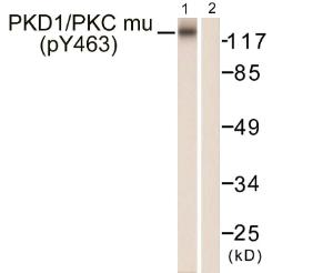 Western blot analysis of lysates from HepG2 cells using Anti-PKC mu (phospho Tyr463) Antibody The right hand lane represents a negative control, where the antibody is blocked by the immunising peptide