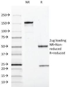 SDS-PAGE analysis of Anti-SOX10 Antibody [SOX10/991] under non-reduced and reduced conditions; showing intact IgG and intact heavy and light chains, respectively. SDS-PAGE analysis confirms the integrity and purity of the antibody